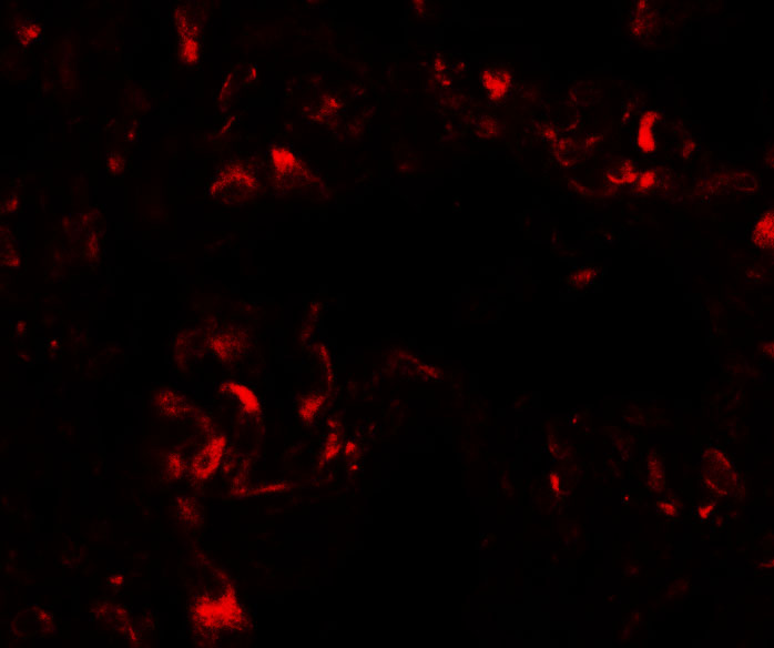 Immunofluorescence of FOXRED2 in human lung cells with FOXRED2 antibody at 20 μg/mL. Immunofluorescence of FOXRED2 in human lung cells with FOXRED2 antibody at 20 μg/mL.