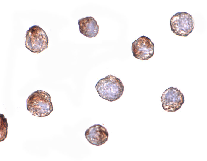Immunocytochemistry of Fibulin 3 in HeLa cells with Fibulin 3 antibody at 20 μg/mL. Immunocytochemistry of Fibulin 3 in HeLa cells with Fibulin 3 antibody at 20 μg/mL.