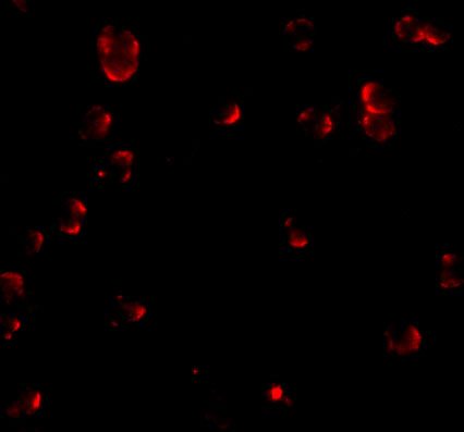 Immunofluorescence of Fibulin 3 in HeLa cells with Fibulin 3 antibody at 20 μg/mL. Immunofluorescence of Fibulin 3 in HeLa cells with Fibulin 3 antibody at 20 μg/mL.