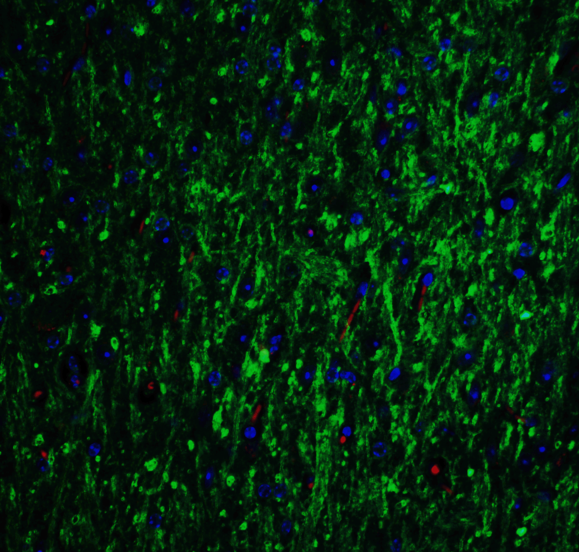 <strong>Figure 6 Immunofluorescence Validation of GLS2 in Mouse Brain</strong><br>
Immunofluorescent analysis of 4% paraformaldehyde-fixed mouse brain labeling GLS2 with 6217 at 20 μg g/mL, followed by goat anti-rabbit IgG secondary antibody at 1/500 dilution (green) and DAPI antibody (blue) <strong>Figure 6 Immunofluorescence Validation of GLS2 in Mouse Brain</strong><br>
Immunofluorescent analysis of 4% paraformaldehyde-fixed mouse brain labeling GLS2 with 6217 at 20 μg g/mL, followed by goat anti-rabbit IgG secondary antibody at 1/500 dilution (green) and DAPI antibody (blue)
