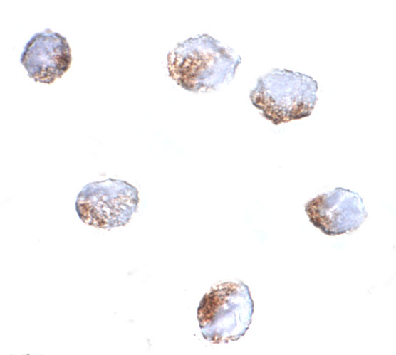 Immunocytochemistry of GNPDA2 in 293 cells with GNPDA2 antibody at 4 μg/mL. Immunocytochemistry of GNPDA2 in 293 cells with GNPDA2 antibody at 4 μg/mL.