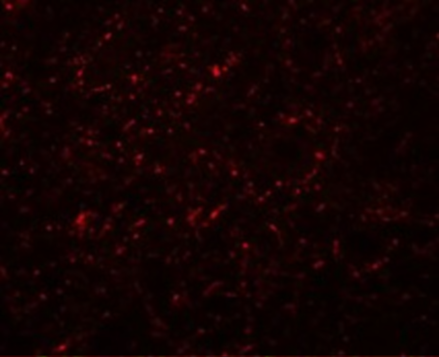 Immunofluorescence of GRB10 in rat brain cells with GRB10 antibody at 20 μg/mL. Immunofluorescence of GRB10 in rat brain cells with GRB10 antibody at 20 μg/mL.