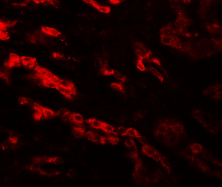 Immunofluorescence of GZF1 in human kidney tissue with GZF1 antibody at 20 μg/mL. Immunofluorescence of GZF1 in human kidney tissue with GZF1 antibody at 20 μg/mL.