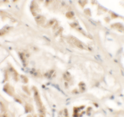 Immunohistochemistry of GZF1 in human kidney tissue with GZF1 antibody at 2.5 μg/mL. Immunohistochemistry of GZF1 in human kidney tissue with GZF1 antibody at 2.5 μg/mL.