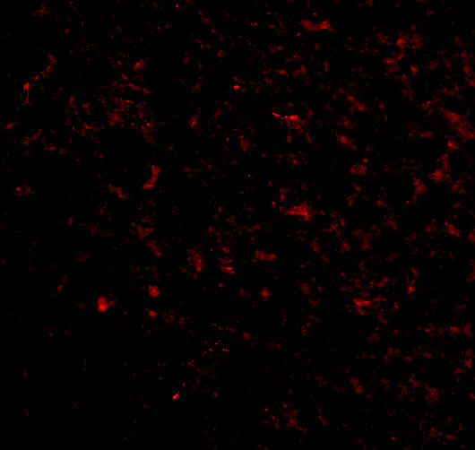 Immunofluorescence of Grik5 in Human Brain cells with Grik5 antibody at 20 μg/mL. Immunofluorescence of Grik5 in Human Brain cells with Grik5 antibody at 20 μg/mL.