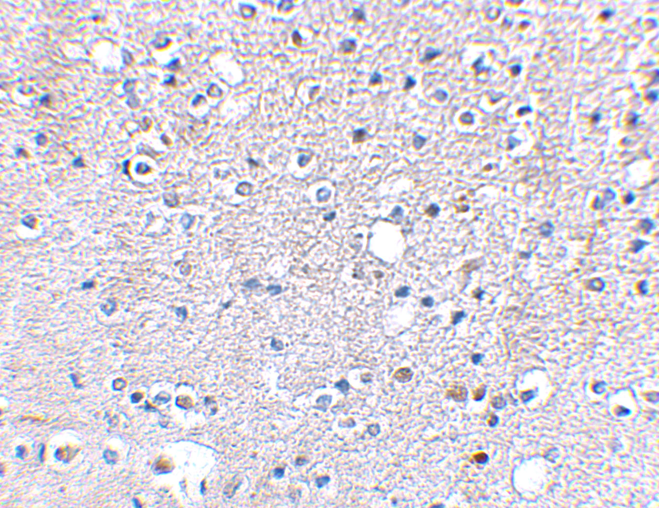 Immunohistochemical staining of human brain tissue using Grik5 antibody at 2.5 μg/mL. Immunohistochemical staining of human brain tissue using Grik5 antibody at 2.5 μg/mL.