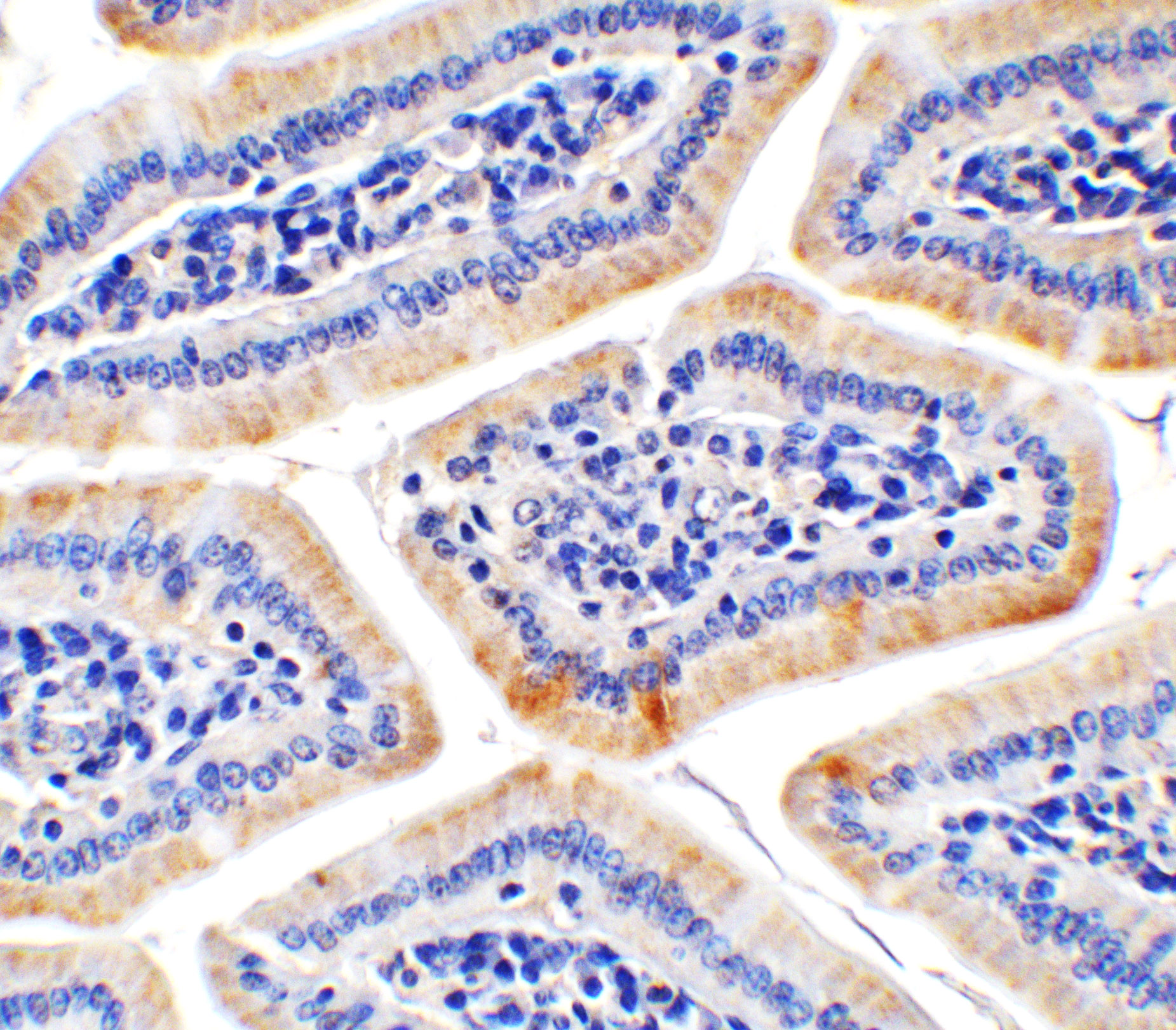 Immunohistochemistry of HAAO in mouse colon tissue with HAAO antibody at 2 μg/mL. Immunohistochemistry of HAAO in mouse colon tissue with HAAO antibody at 2 μg/mL.