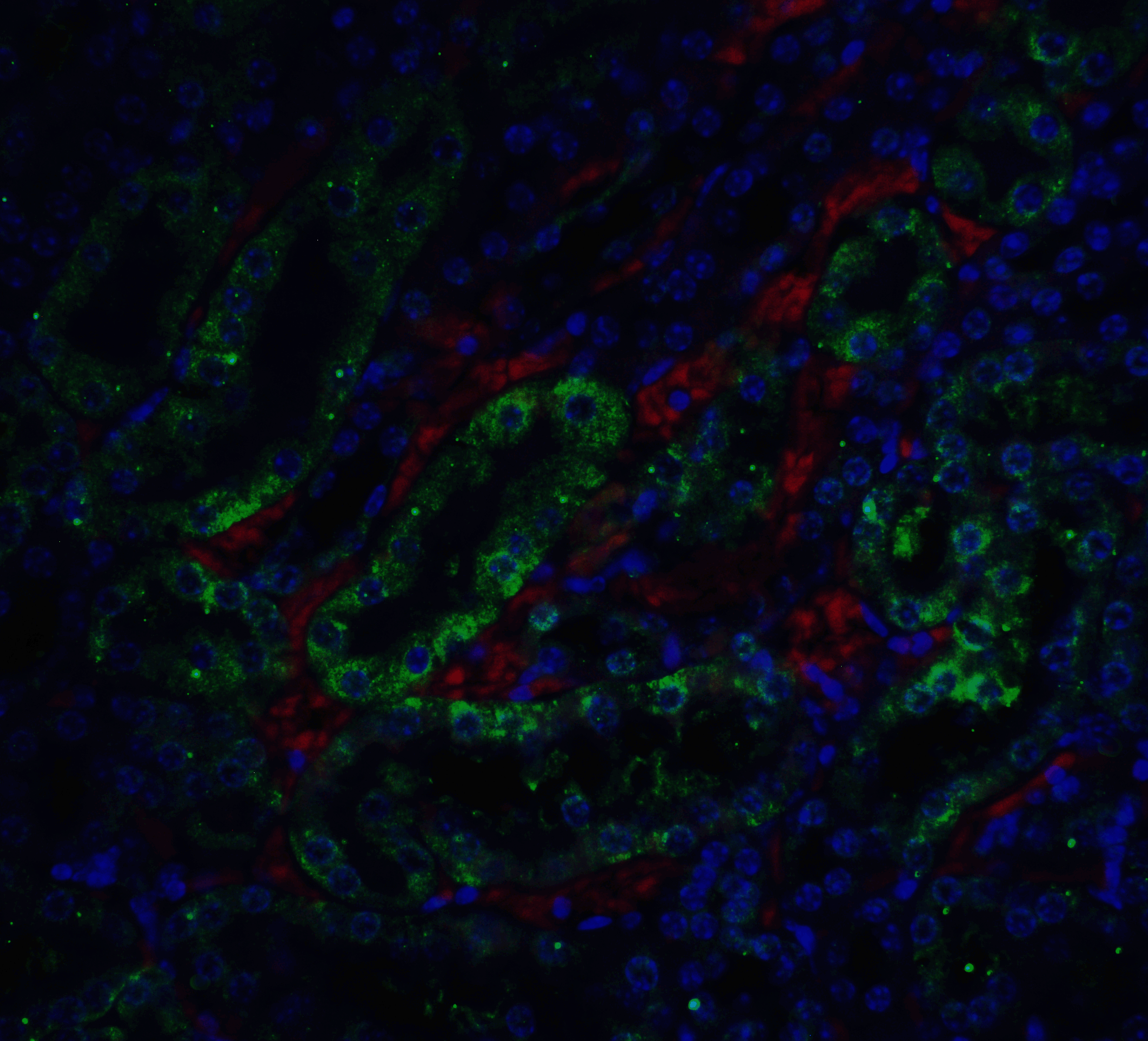Immunofluorescence of ICAD in mouse kidney tissue with ICAD antibody at 5 μg/ml. <br><br>Green: ICAD antibody (2003) <br> Red: Phylloidin staining<br> Blue: DAPI staining Immunofluorescence of ICAD in mouse kidney tissue with ICAD antibody at 5 μg/ml. <br><br>Green: ICAD antibody (2003) <br> Red: Phylloidin staining<br> Blue: DAPI staining