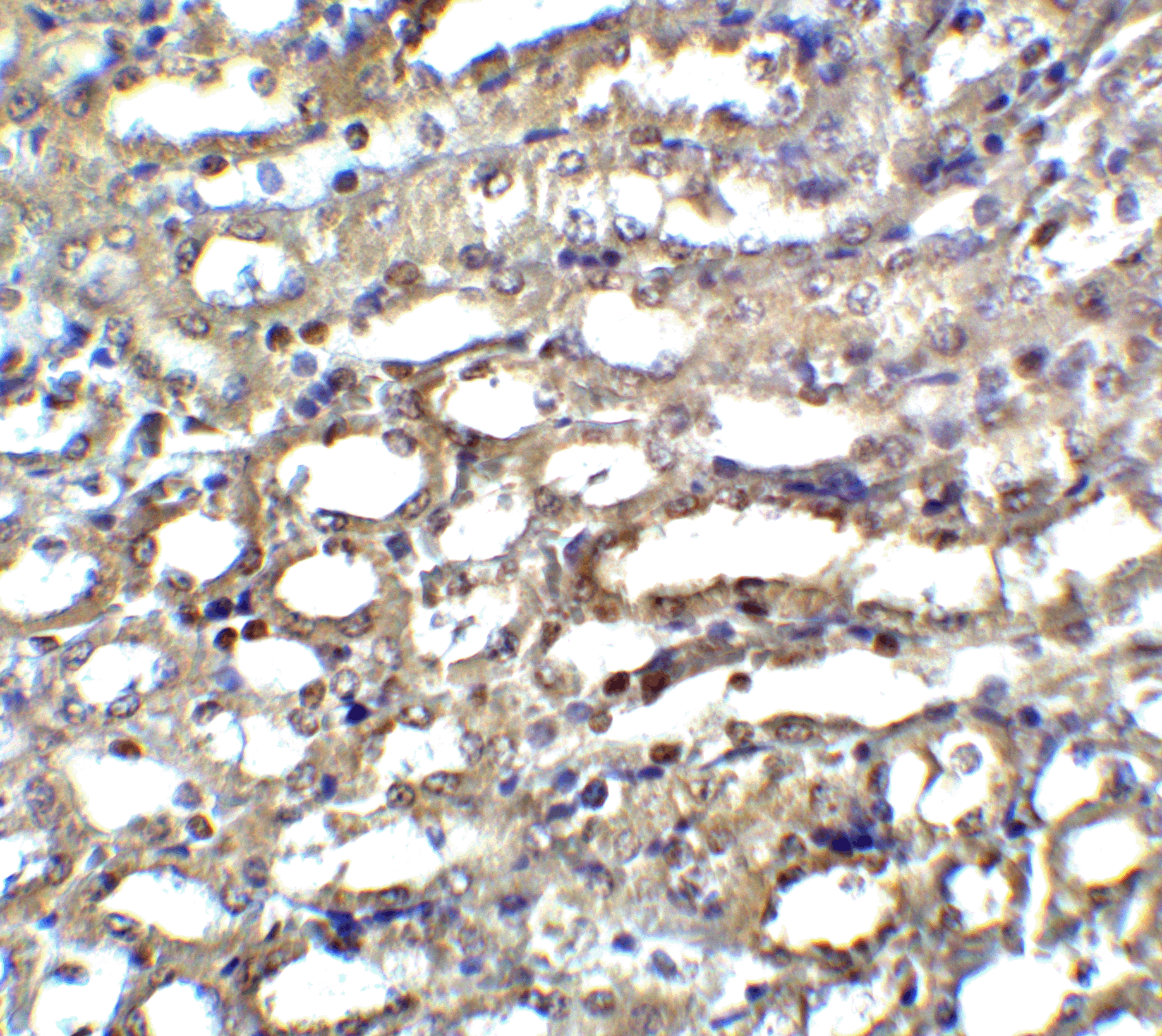 Immunohistochemistry of ICAD in mouse kidney tissue with ICAD antibody at 5 μg/ml. Immunohistochemistry of ICAD in mouse kidney tissue with ICAD antibody at 5 μg/ml.