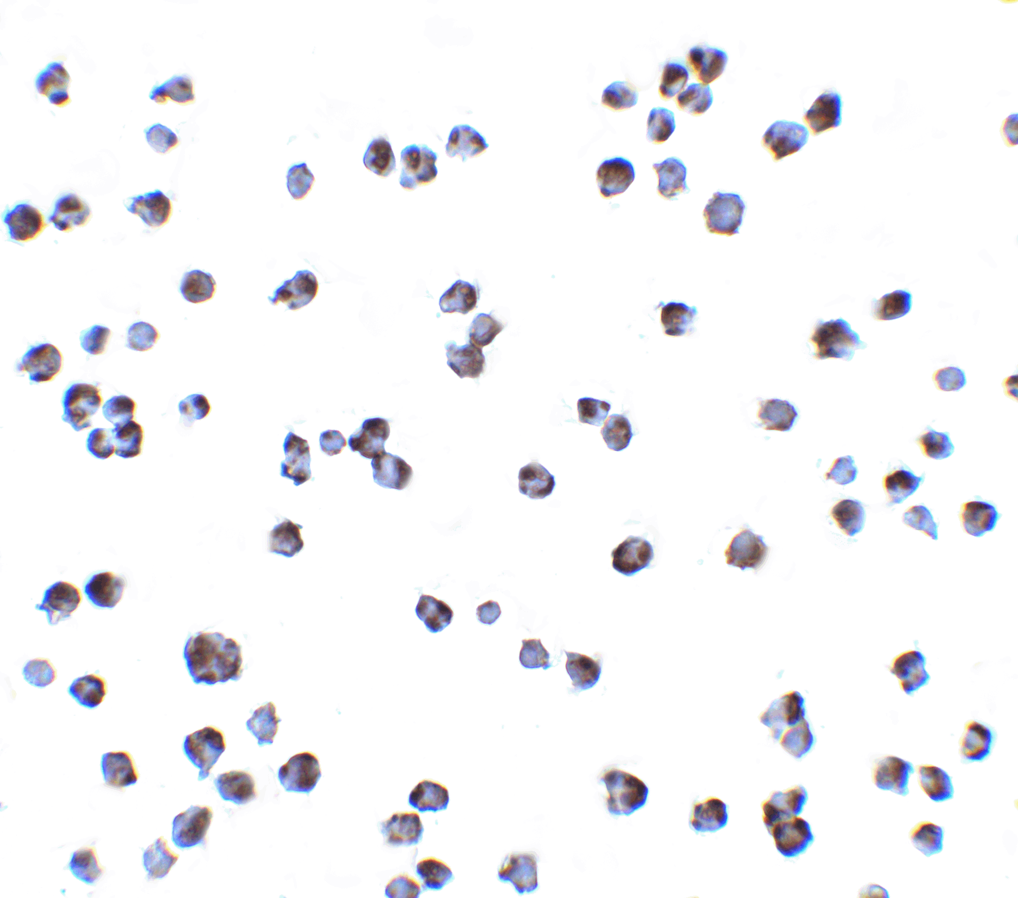 Immunocytochemistry of IKKa in Jurkat cells with IKK alpha antibody at 2 μg/mL. Immunocytochemistry of IKKa in Jurkat cells with IKK alpha antibody at 2 μg/mL.