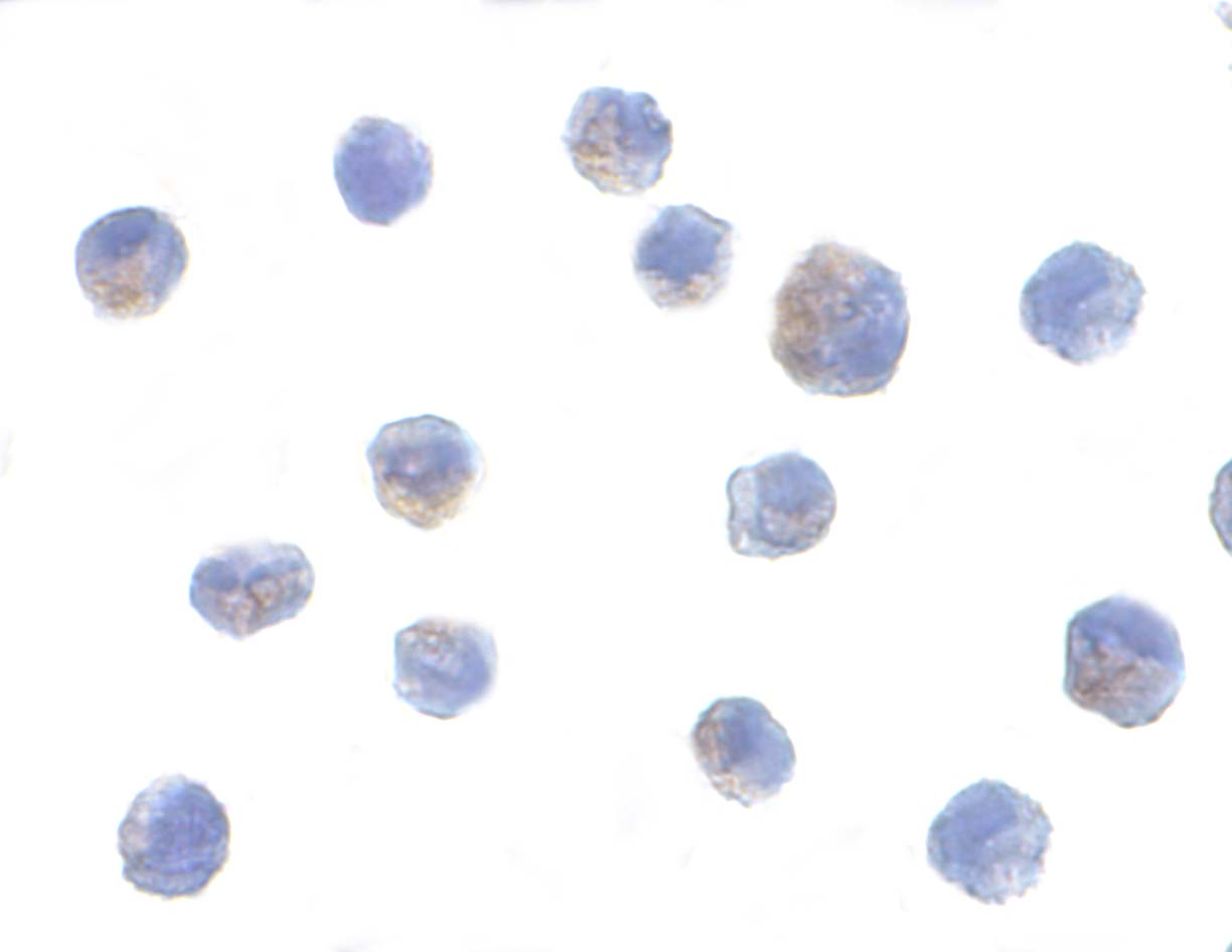 Immunocytochemistry of IKK alpha in Jurkat cells with IKK alpha antibody at 10 μg/mL. Immunocytochemistry of IKK alpha in Jurkat cells with IKK alpha antibody at 10 μg/mL.