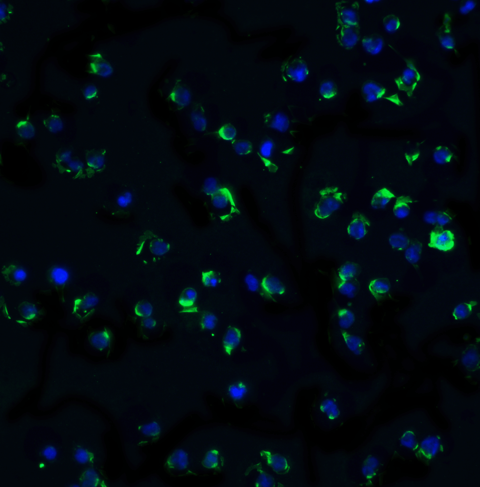 Immunofluorescence of IKKa in Jurkat cells with IKK alpha antibody at 20 μg/mL.<br><br>Green: IKK alpha Antibody (2025) <br> Blue: DAPI staining Immunofluorescence of IKKa in Jurkat cells with IKK alpha antibody at 20 μg/mL.<br><br>Green: IKK alpha Antibody (2025) <br> Blue: DAPI staining