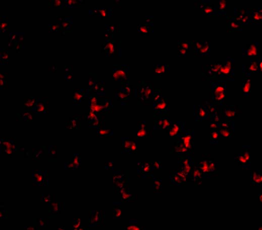 Immunofluorescence of IKK alpha in Jurkat cells with IKK alpha antibody at 10 μg/mL. Immunofluorescence of IKK alpha in Jurkat cells with IKK alpha antibody at 10 μg/mL.