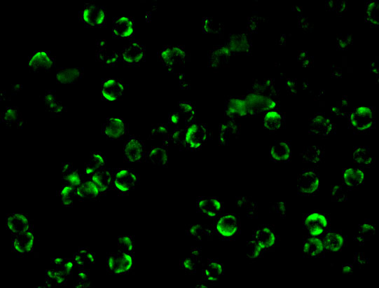 Immunofluorescence of IKK beta in Hela cells with IKK beta antibody at 10 μg/mL. Immunofluorescence of IKK beta in Hela cells with IKK beta antibody at 10 μg/mL.