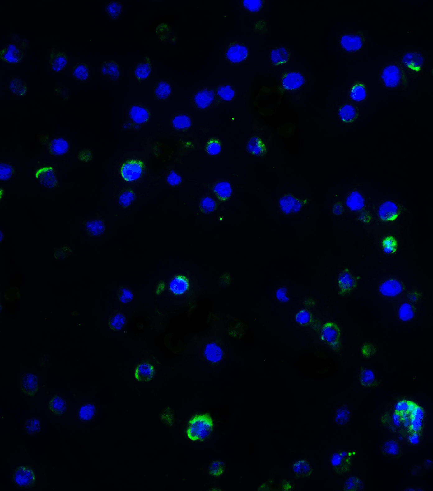 <strong>Figure 5 Immunofluorescence Validation of IL-17 in Mouse A-20 Cells</strong><br>
Immunofluorescent analysis of 4% paraformaldehyde-fixed mouse A-20 Cells labeling IL-17 with 4887 at 5 μg/mL, followed by goat anti-rabbit IgG secondary antibody at 1/500 dilution (green) and DAPI staining (blue). <strong>Figure 5 Immunofluorescence Validation of IL-17 in Mouse A-20 Cells</strong><br>
Immunofluorescent analysis of 4% paraformaldehyde-fixed mouse A-20 Cells labeling IL-17 with 4887 at 5 μg/mL, followed by goat anti-rabbit IgG secondary antibody at 1/500 dilution (green) and DAPI staining (blue).