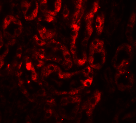 <strong>Figure 6 Immunofluorescence Validation of IL-17 in Mouse Thymus Tissue</strong><br>
Immunofluorescent analysis of 4% paraformaldehyde-fixed mouse thymus tissue labeling IL-17 with 4887 at 20 μg/mL, followed by goat anti-rabbit IgG secondary antibody at 1/500 dilution (red). <strong>Figure 6 Immunofluorescence Validation of IL-17 in Mouse Thymus Tissue</strong><br>
Immunofluorescent analysis of 4% paraformaldehyde-fixed mouse thymus tissue labeling IL-17 with 4887 at 20 μg/mL, followed by goat anti-rabbit IgG secondary antibody at 1/500 dilution (red).