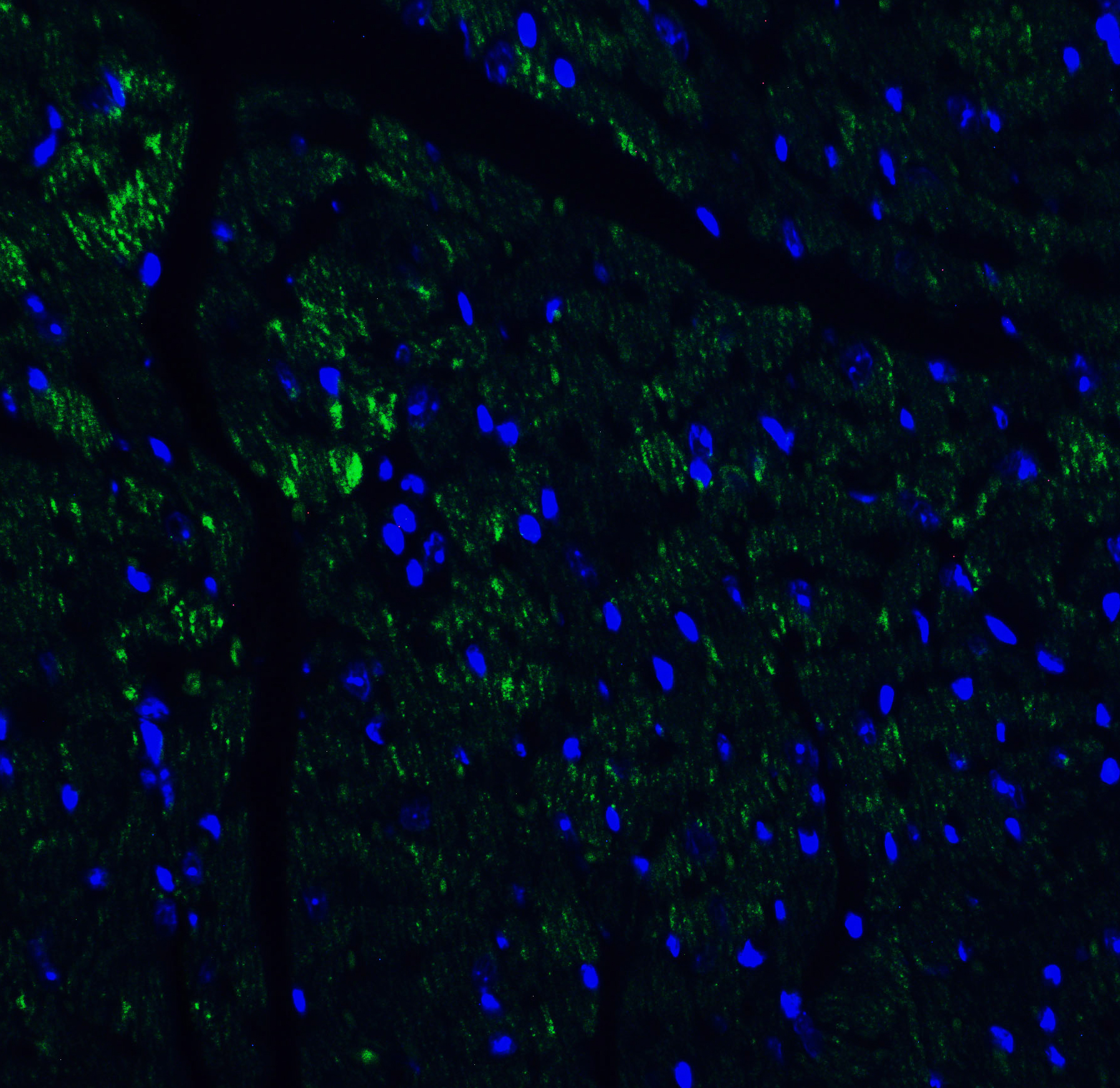 <strong>Figure 4 Immunofluorescence Validation of IL-17 in Mouse Heart Tissue</strong><br>
Immunofluorescent analysis of 4% paraformaldehyde-fixed mouse heart issue labeling IL-17 with 4887 at 10 μg/mL, followed by goat anti-rabbit IgG secondary antibody at 1/500 dilution (green) and DAPI staining (blue). <strong>Figure 4 Immunofluorescence Validation of IL-17 in Mouse Heart Tissue</strong><br>
Immunofluorescent analysis of 4% paraformaldehyde-fixed mouse heart issue labeling IL-17 with 4887 at 10 μg/mL, followed by goat anti-rabbit IgG secondary antibody at 1/500 dilution (green) and DAPI staining (blue).