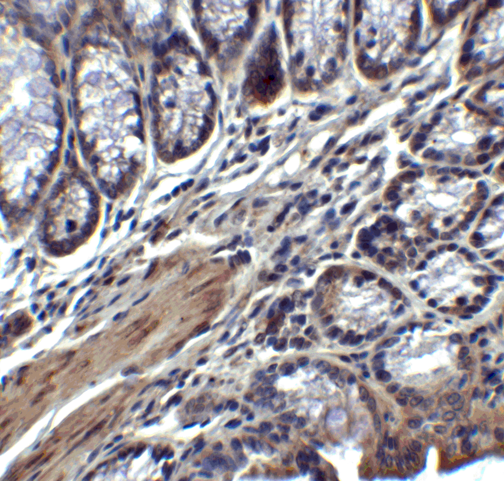 <strong>Figure 7 Immunohistochemistry Validation of IL-17 in Mouse Colon Tissue </strong><br>
Immunohistochemical analysis of paraffin-embedded mouse colon tissue using anti-IL-17 antibody (4887) at 2 μg/mL. Tissue was fixed with formaldehyde and blocked with 10% serum for 1 h at RT; antigen retrieval was by heat mediation with a citrate buffer (pH6). Samples were incubated with primary antibody overnight at 4˚ C. A goat anti-rabbit IgG H&L (HRP) at 1/250 was used as secondary. Counter stained with Hematoxylin. <strong>Figure 7 Immunohistochemistry Validation of IL-17 in Mouse Colon Tissue </strong><br>
Immunohistochemical analysis of paraffin-embedded mouse colon tissue using anti-IL-17 antibody (4887) at 2 μg/mL. Tissue was fixed with formaldehyde and blocked with 10% serum for 1 h at RT; antigen retrieval was by heat mediation with a citrate buffer (pH6). Samples were incubated with primary antibody overnight at 4˚ C. A goat anti-rabbit IgG H&L (HRP) at 1/250 was used as secondary. Counter stained with Hematoxylin.
