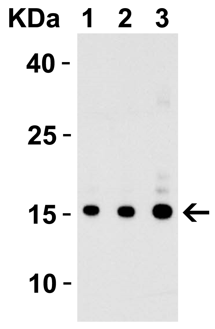 <strong>Figure 1 Western Blot Validation with Recombinant Protein</strong><br>
Loading: 30 ng of human IL-17 recombinant protein per lane.
Antibodies: IL-17 4887, 1h incubation at RT in 5% NFDM/TBST.
Secondary: Goat anti-rabbit IgG HRP conjugate at 1:10000 dilution.
Lane 1: 0.125 μg/mL
Lane 2: 0.25 μg/mL
Lane 3: 0.5 μg/mL <strong>Figure 1 Western Blot Validation with Recombinant Protein</strong><br>
Loading: 30 ng of human IL-17 recombinant protein per lane.
Antibodies: IL-17 4887, 1h incubation at RT in 5% NFDM/TBST.
Secondary: Goat anti-rabbit IgG HRP conjugate at 1:10000 dilution.
Lane 1: 0.125 μg/mL
Lane 2: 0.25 μg/mL
Lane 3: 0.5 μg/mL