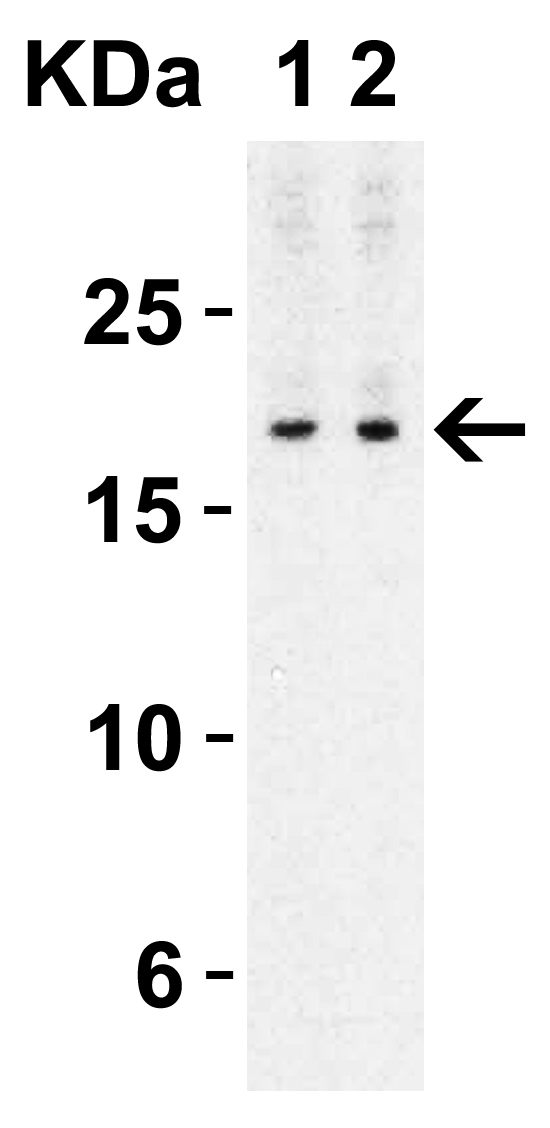 <strong>Figure 2 Western Blot Validation with Human Spleen </strong><br>
Loading: 10 μg of lysates per lane.
Antibodies: IL-17 4887, 1h incubation at RT in 5% NFDM/TBST.
Secondary: Goat anti-rabbit IgG HRP conjugate at 1:10000 dilution.
Exposure: 1 min
Lane 1: 1 μg/mL
Lane 2: 2 μg/mL <strong>Figure 2 Western Blot Validation with Human Spleen </strong><br>
Loading: 10 μg of lysates per lane.
Antibodies: IL-17 4887, 1h incubation at RT in 5% NFDM/TBST.
Secondary: Goat anti-rabbit IgG HRP conjugate at 1:10000 dilution.
Exposure: 1 min
Lane 1: 1 μg/mL
Lane 2: 2 μg/mL