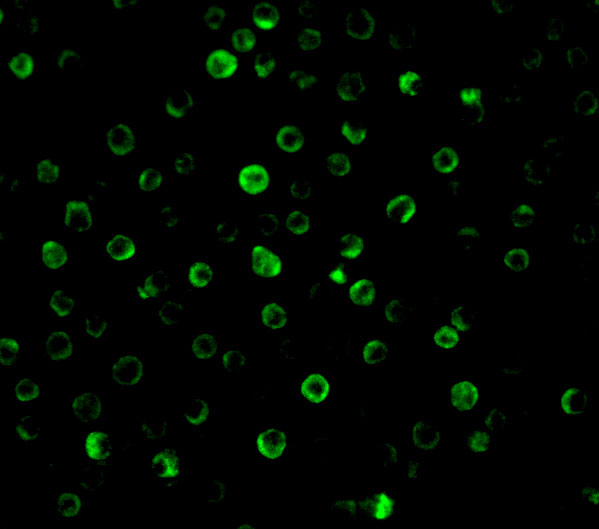 Immunofluorescence of IL-22 receptor in HepG2 cells with IL-22 receptor antibody at 10 μg/mL. Immunofluorescence of IL-22 receptor in HepG2 cells with IL-22 receptor antibody at 10 μg/mL.