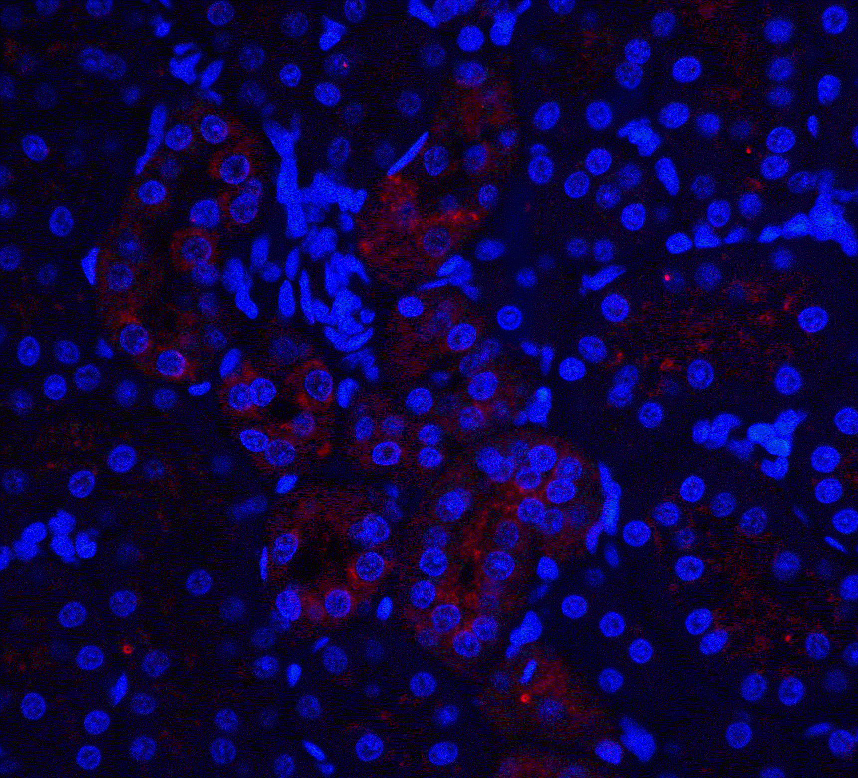 Immunofluorescence of IL-22R in rat kidney tissue with IL-22R antibody at 20 μg/ml. Immunofluorescence of IL-22R in rat kidney tissue with IL-22R antibody at 20 μg/ml.