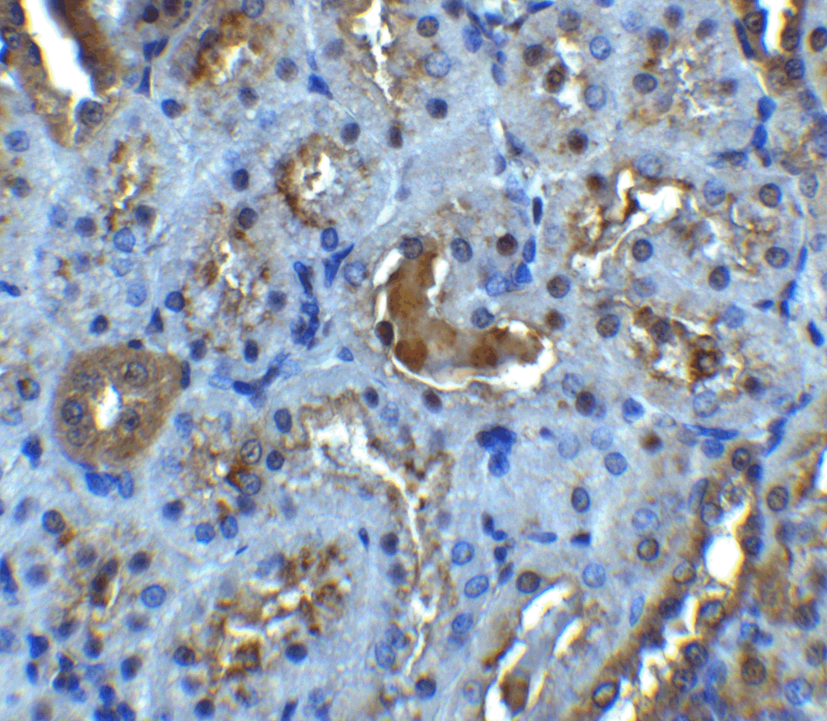 Immunohistochemistry of IL-22R in rat kidney tissue with IL-22R antibody at 5 μg/mL. Immunohistochemistry of IL-22R in rat kidney tissue with IL-22R antibody at 5 μg/mL.