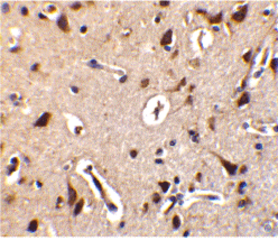 Immunohistochemistry of ILPIP in human brain tissue with ILPIP antibody at 10 μg/mL. Immunohistochemistry of ILPIP in human brain tissue with ILPIP antibody at 10 μg/mL.