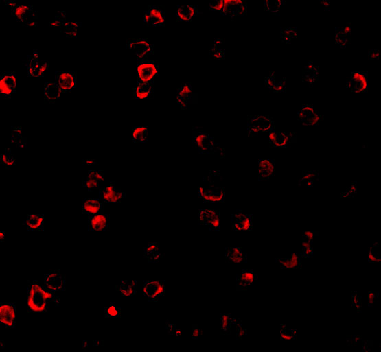 Immunofluorescence of IRF3 in Ramos cells with IRF3 antibody at 2 μg/mL. Immunofluorescence of IRF3 in Ramos cells with IRF3 antibody at 2 μg/mL.