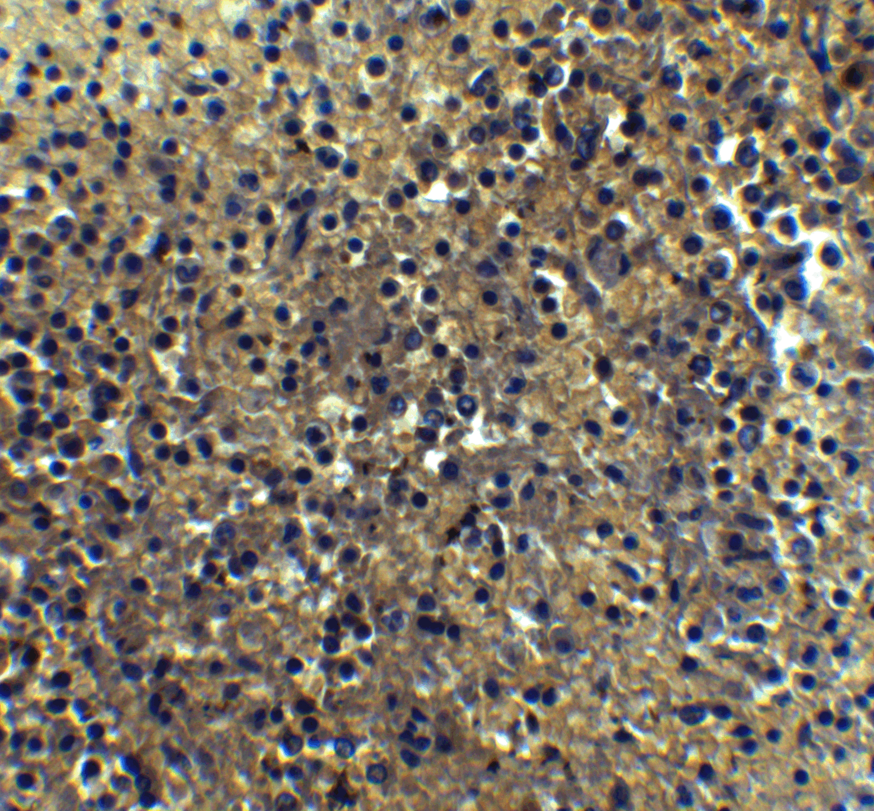 Immunohistochemistry of IRF7 in human spleen tissue with IRF7 Antibody at 5 μg/mL. Immunohistochemistry of IRF7 in human spleen tissue with IRF7 Antibody at 5 μg/mL.