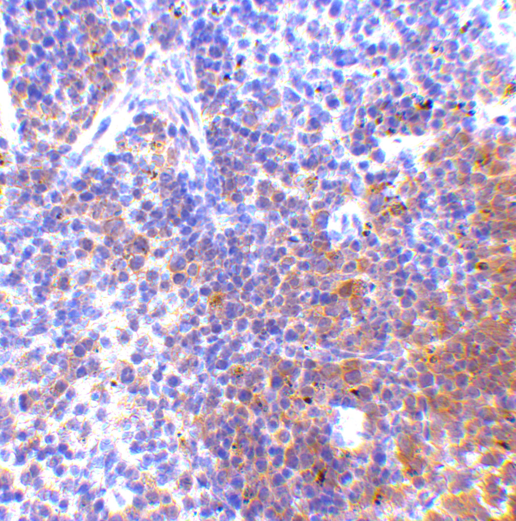 Immunohistochemistry of IRF7 in mouse spleen tissue with IRF7 antibody at 5 μg/mL. Immunohistochemistry of IRF7 in mouse spleen tissue with IRF7 antibody at 5 μg/mL.