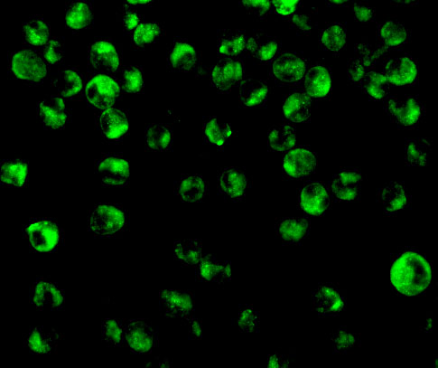 Immunofluorescence of IRF8 in K562 cells with IRF8 antibody at 10 μg/mL. Immunofluorescence of IRF8 in K562 cells with IRF8 antibody at 10 μg/mL.