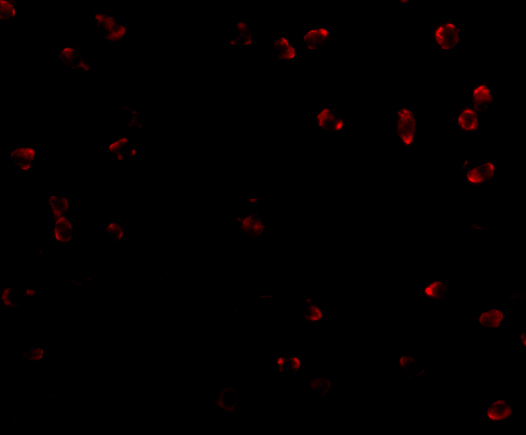 Immunofluorescence of Integrin alpha 4 in Jurkat cells with Integrin alpha 4 antibody at 2 μg/mL. Immunofluorescence of Integrin alpha 4 in Jurkat cells with Integrin alpha 4 antibody at 2 μg/mL.