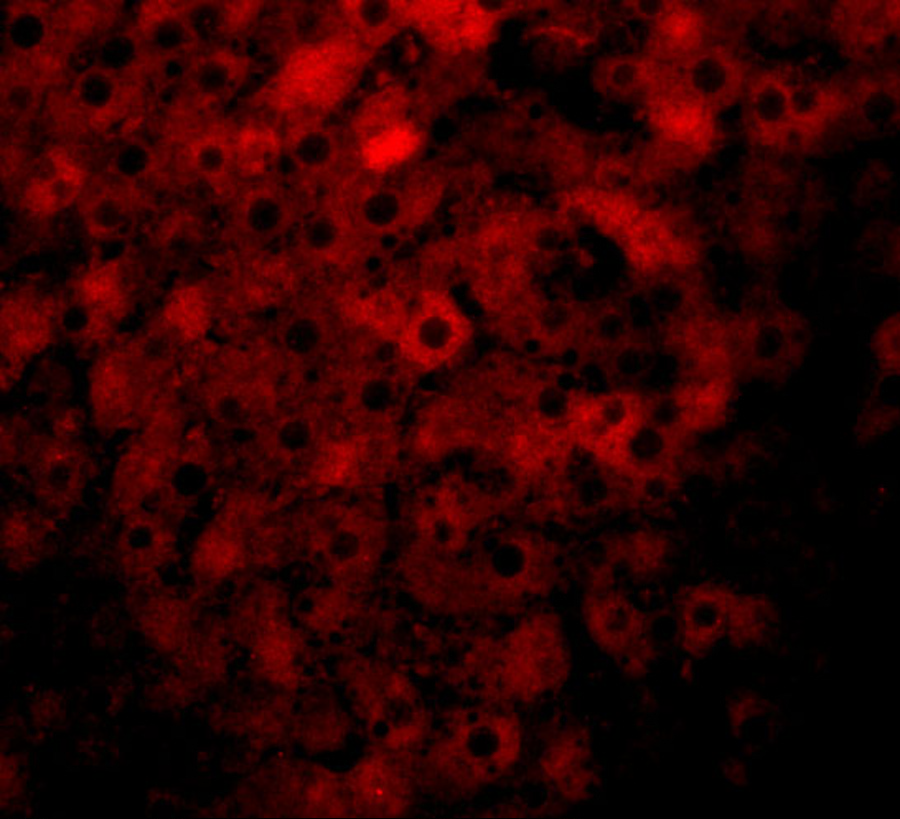 Immunofluorescence of JMJD1B in rat liver tissue with JMJD1B antibody at 20 μg/mL. Immunofluorescence of JMJD1B in rat liver tissue with JMJD1B antibody at 20 μg/mL.