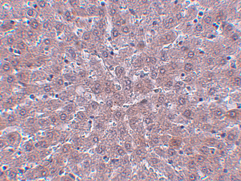 Immunohistochemistry of JMJD1B in rat liver tissue with JMJD1B antibody at 2.5 μg/mL. Immunohistochemistry of JMJD1B in rat liver tissue with JMJD1B antibody at 2.5 μg/mL.