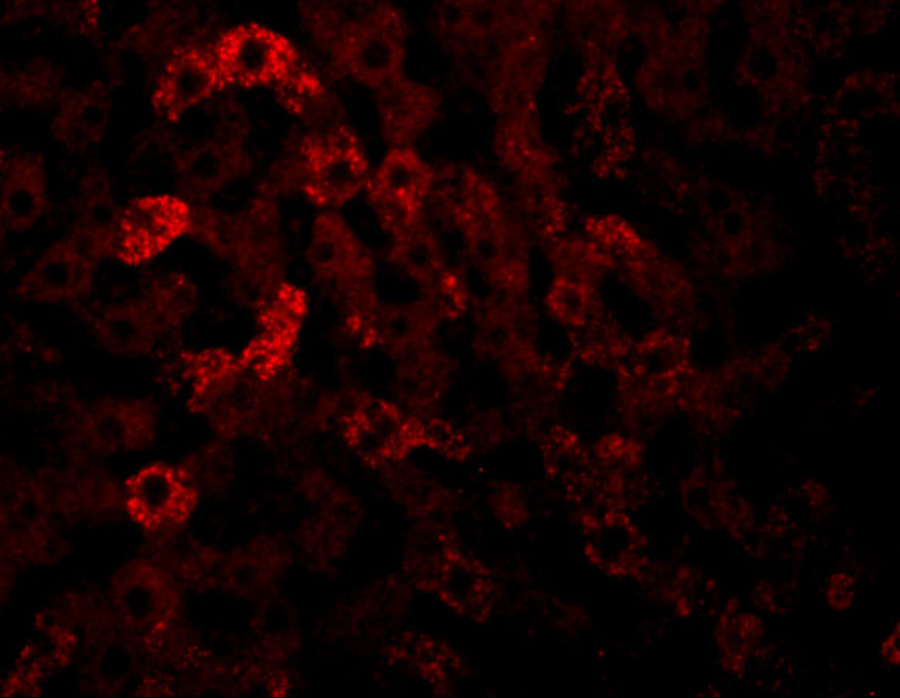 Immunofluorescence of JMJD7 in rat liver tissue with JMJD7 antibody at 20 μg/mL. Immunofluorescence of JMJD7 in rat liver tissue with JMJD7 antibody at 20 μg/mL.
