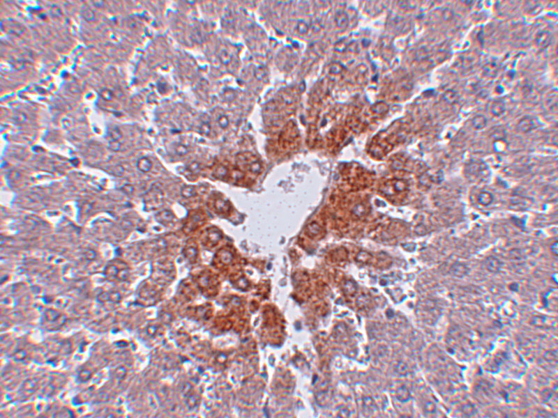 Immunohistochemistry of JMJD7 in rat liver tissue with JMJD7 antibody at 2.5 μg/mL. Immunohistochemistry of JMJD7 in rat liver tissue with JMJD7 antibody at 2.5 μg/mL.