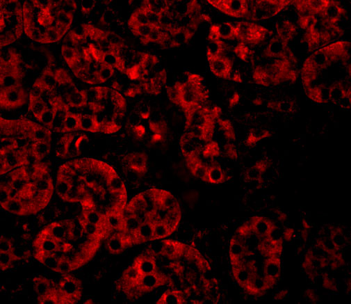 Immunofluorescence of JMJD8 in Mouse Kidney cells with JMJD8 antibody at 20 μg/mL. Immunofluorescence of JMJD8 in Mouse Kidney cells with JMJD8 antibody at 20 μg/mL.