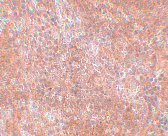 Immunohistochemistry of JMJD8 in mouse spleen tissue with JMJD8 antibody at 2.5 μg/mL. Immunohistochemistry of JMJD8 in mouse spleen tissue with JMJD8 antibody at 2.5 μg/mL.