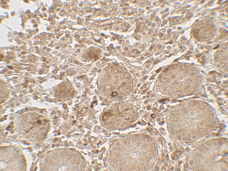 Immunohistochemistry of LAMTOR1 in human small intestine tissue with LAMTOR1 antibody at 5 μg/mL. Immunohistochemistry of LAMTOR1 in human small intestine tissue with LAMTOR1 antibody at 5 μg/mL.