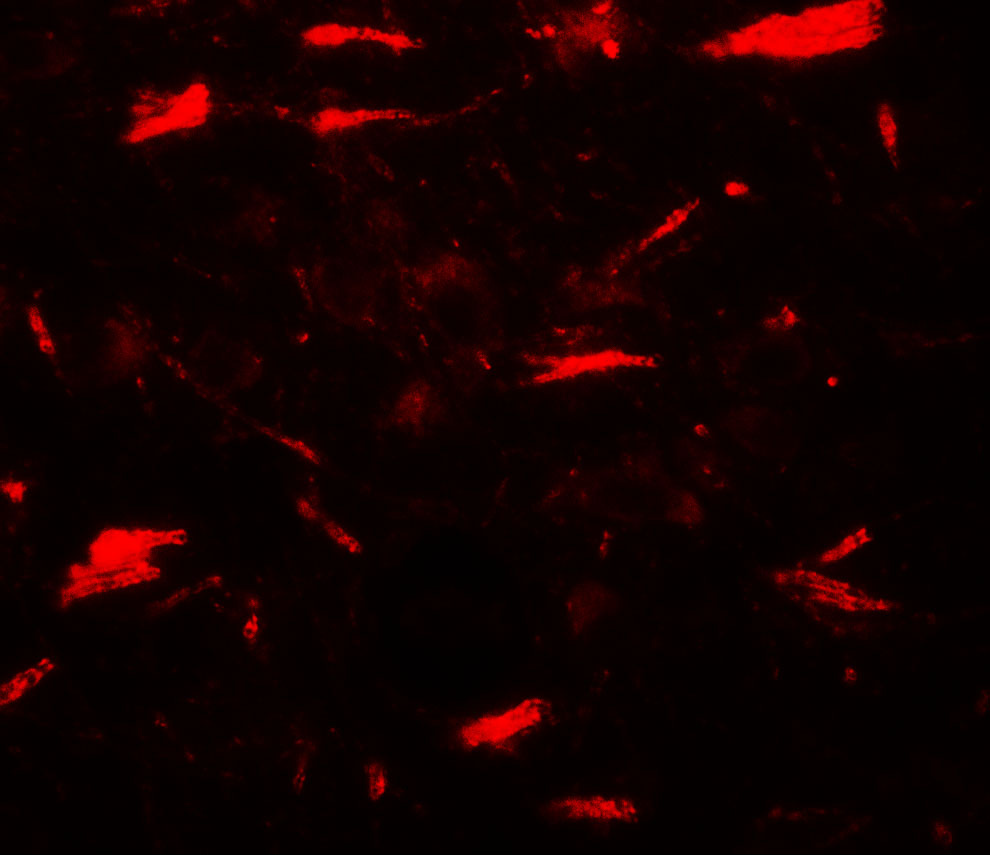 Immunofluorescence of LAMTOR3 in human brain tissue with LAMTOR3 antibody at 20 μg/mL. Immunofluorescence of LAMTOR3 in human brain tissue with LAMTOR3 antibody at 20 μg/mL.