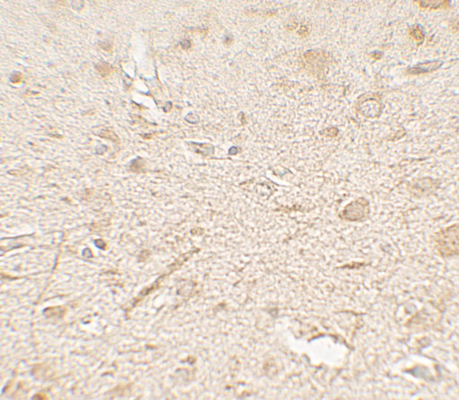 Immunohistochemistry of LAMTOR3 in human brain tissue with LAMTOR3 antibody at 5 μg/mL. Immunohistochemistry of LAMTOR3 in human brain tissue with LAMTOR3 antibody at 5 μg/mL.