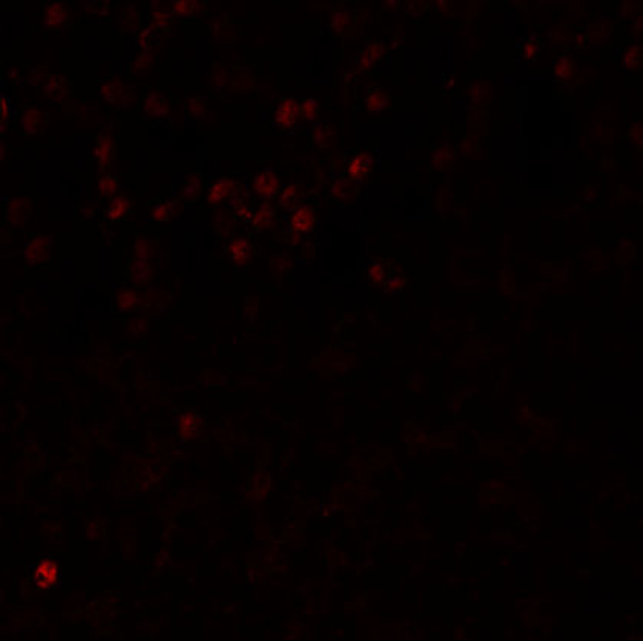 Immunofluorescence of LMBRD1 in human brain tissue with LMBRD1 antibody at 20 μg/mL. Immunofluorescence of LMBRD1 in human brain tissue with LMBRD1 antibody at 20 μg/mL.