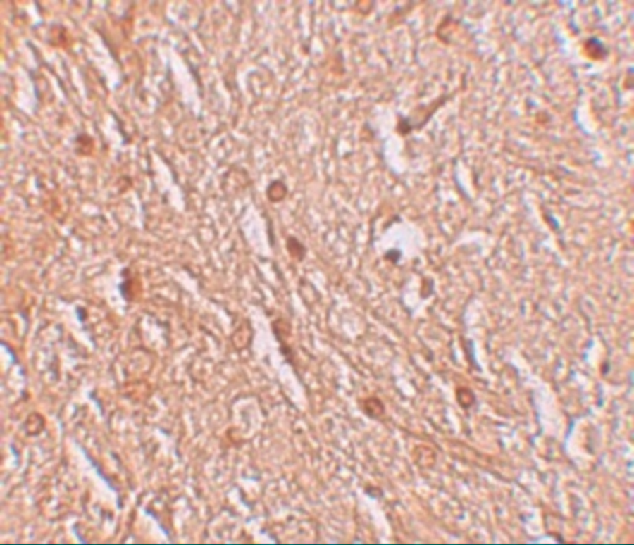 Immunohistochemistry of LMBRD1 in human brain tissue with LMBRD1 antibody at 2.5 μg/mL. Immunohistochemistry of LMBRD1 in human brain tissue with LMBRD1 antibody at 2.5 μg/mL.