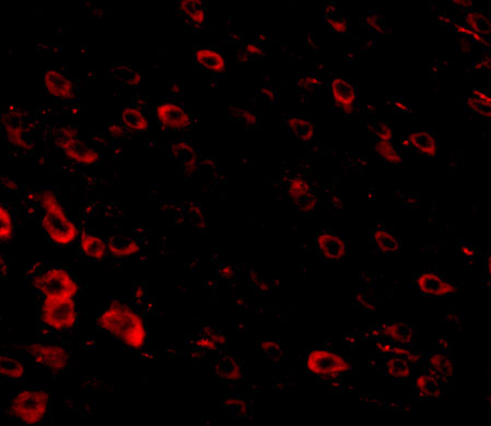 Immunofluorescence of LRFN3 in mouse brain tissue with LRFN3 antibody at 20 μg/mL. Immunofluorescence of LRFN3 in mouse brain tissue with LRFN3 antibody at 20 μg/mL.