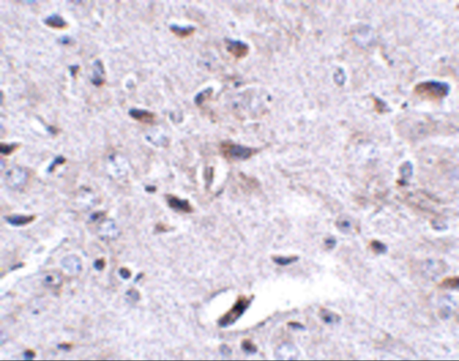 Immunohistochemistry of LRFN3 in mouse brain tissue with LRFN3 antibody at 2.5 μg/mL. Immunohistochemistry of LRFN3 in mouse brain tissue with LRFN3 antibody at 2.5 μg/mL.