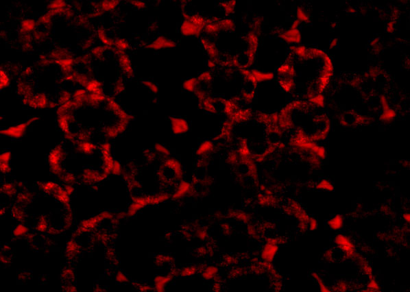 Immunofluorescence of MTCH2 in Mouse Kidney cells with MTCH2 antibody at 20 μg/mL. Immunofluorescence of MTCH2 in Mouse Kidney cells with MTCH2 antibody at 20 μg/mL.