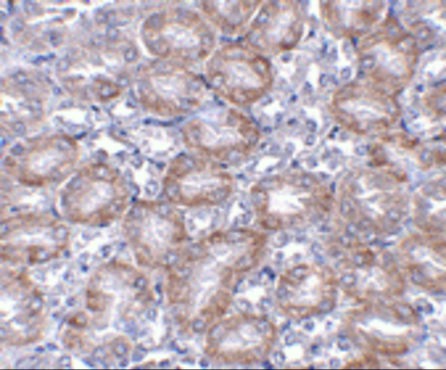 Immunohistochemistry of MTCH2 in mouse kidney tissue with MTCH2 antibody at 5 μg/mL. Immunohistochemistry of MTCH2 in mouse kidney tissue with MTCH2 antibody at 5 μg/mL.