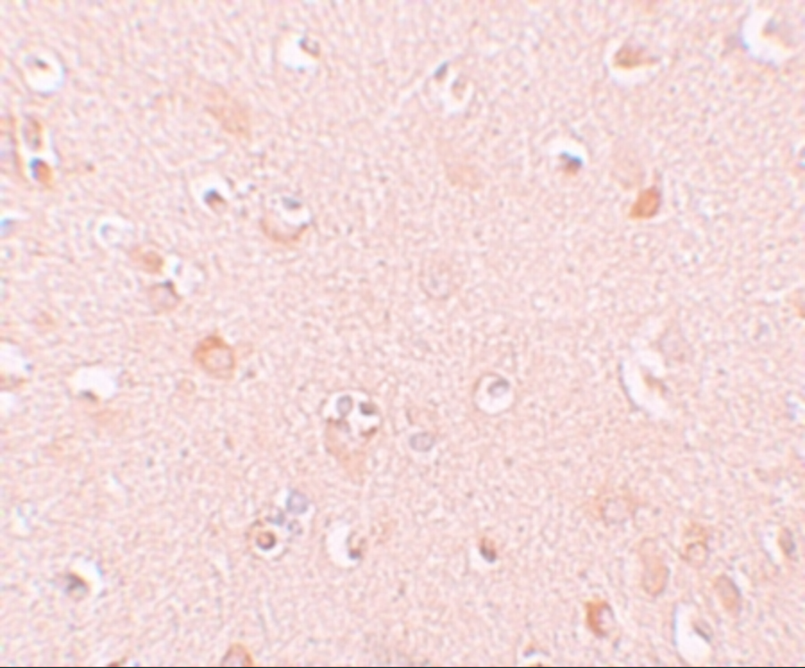Immunohistochemistry of NALP5 in human brain tissue with NALP5 antibody at 10 μg/mL.
