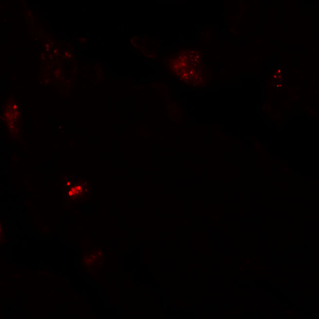 Immunofluorescence of NIBRIN in human lung tissue with NIBRIN antibody at 20 μg/mL. Immunofluorescence of NIBRIN in human lung tissue with NIBRIN antibody at 20 μg/mL.